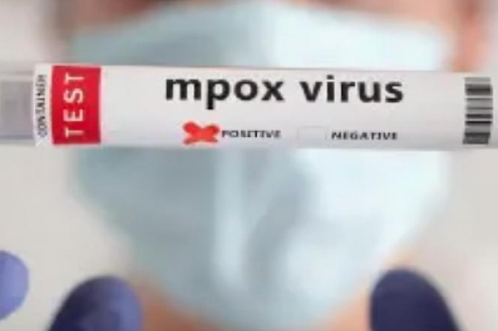 Alemania detecta un nuevo caso de la variante del virus mpox