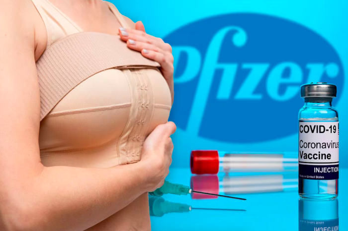 ¿Qué es el “Pfizer Boob Job”?